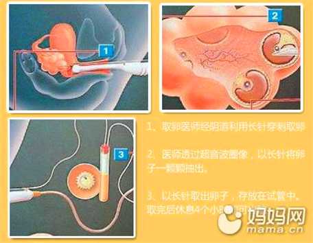 温州代孕-温州代孕哪里最安全-温州一般代孕得多