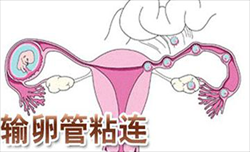 北京代孕需要配型吗，北京办准生证需要什么手续